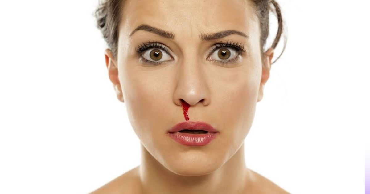 Exploring the Spiritual Meanings of Nose Bleeds