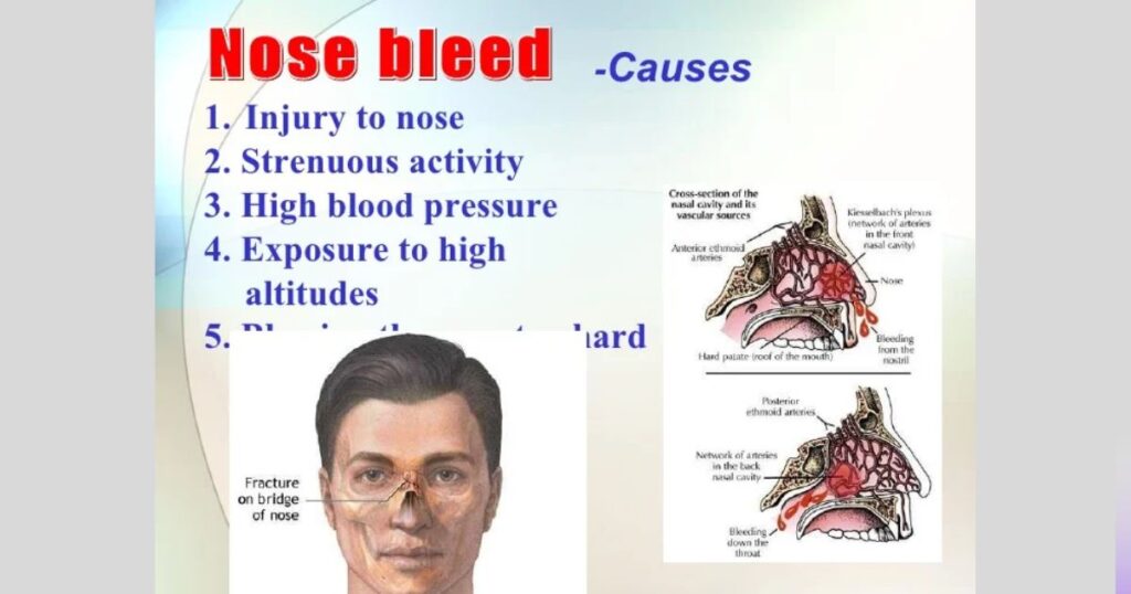 Physical Causes vs Spiritual Causes