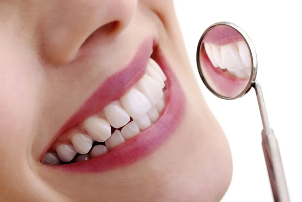 7 Benefits of Visiting a Teeth Whitening Dentist for Stains