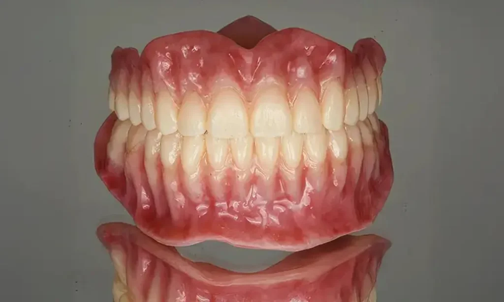 Durable and Natural-Looking Solutions for Dental Restoration