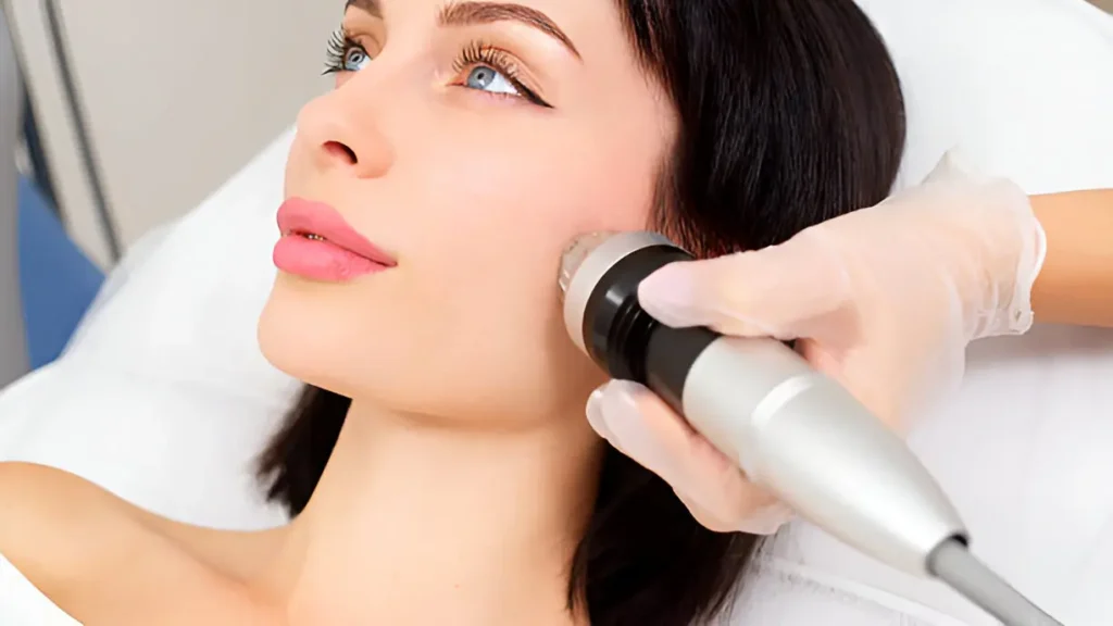  In Order To Have Beautiful Skin – You Definitely Need To Use RF Needling Today.